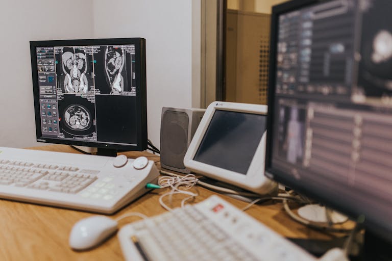 Yolut org imaging setup with MRI scans on multiple screens in a healthcare facility.